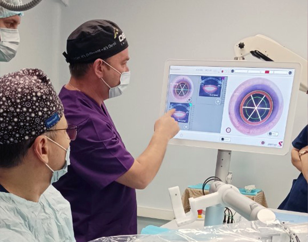 saif-optima-femtocataract